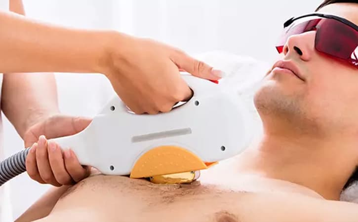 Laser Hair Removal Treatment  Benefit Procedure And Cost