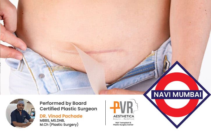 scar-revision-navi-mumbai